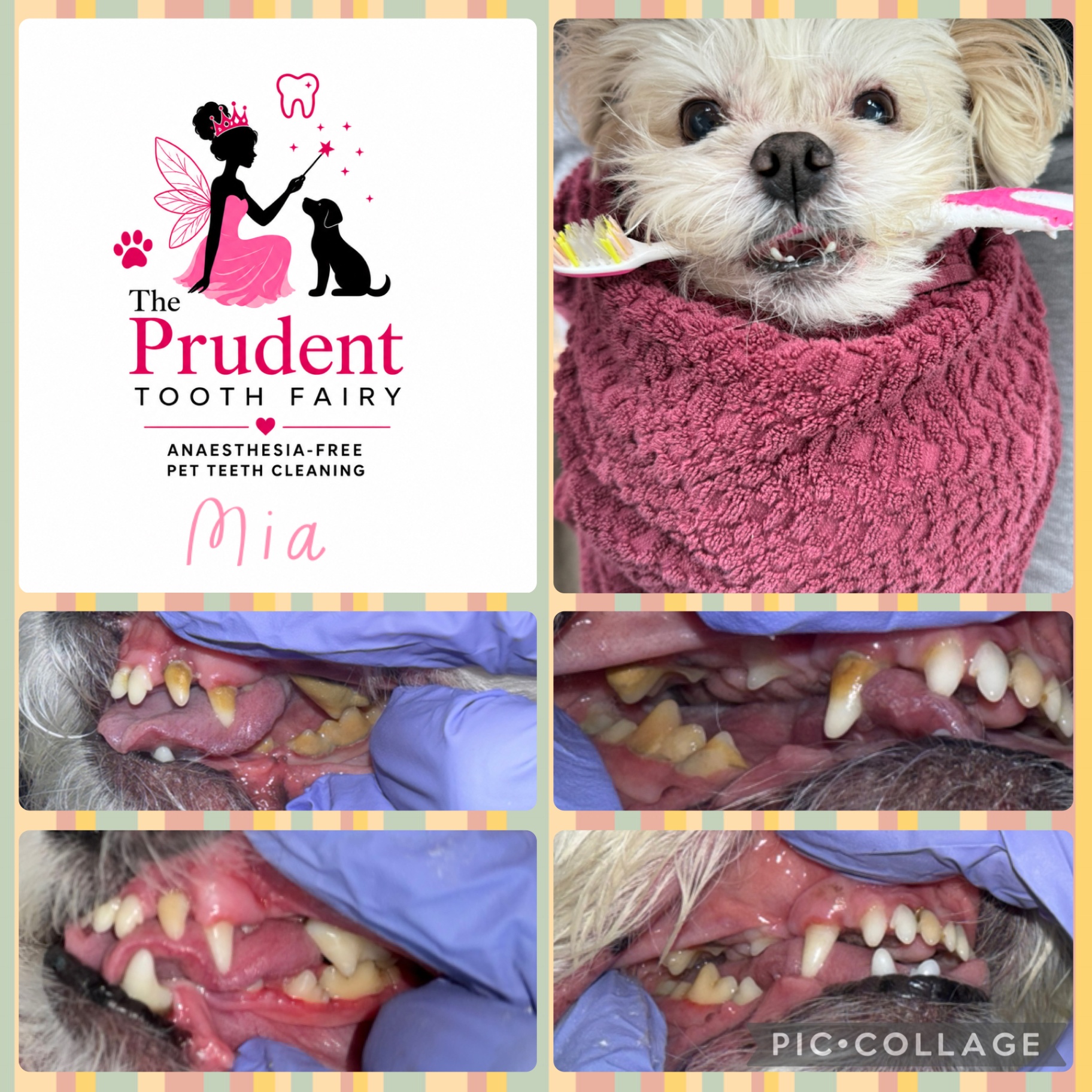 Anesthesia-free cosmetic teeth cleaning, before and after