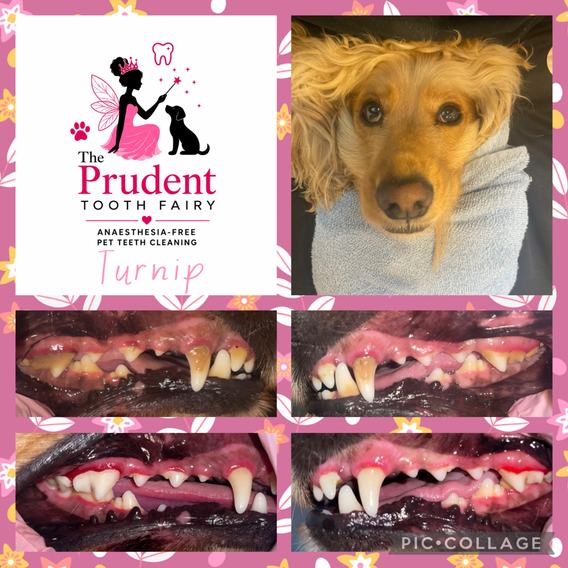 Anesthesia-free cosmetic teeth cleaning, before and after